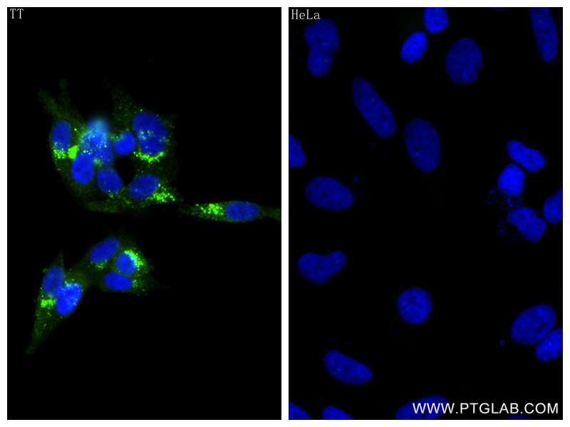 Immunofluorescence (IF) / fluorescent staining of TT cells using CALCA/CGRP Recombinant antibody (83774-1-RR)