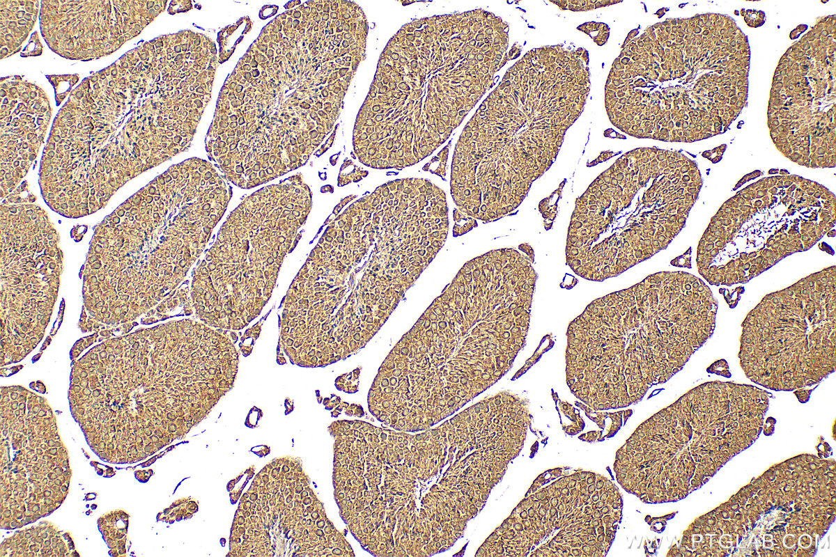 Immunohistochemistry (IHC) staining of mouse testis tissue using CALCOCO1 Polyclonal antibody (19843-1-AP)