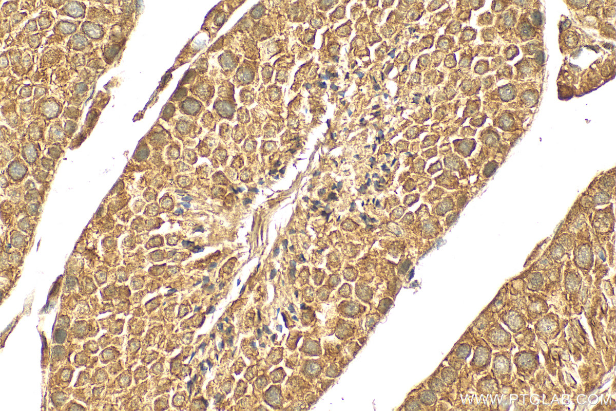 Immunohistochemistry (IHC) staining of mouse testis tissue using CALCOCO1 Polyclonal antibody (19843-1-AP)