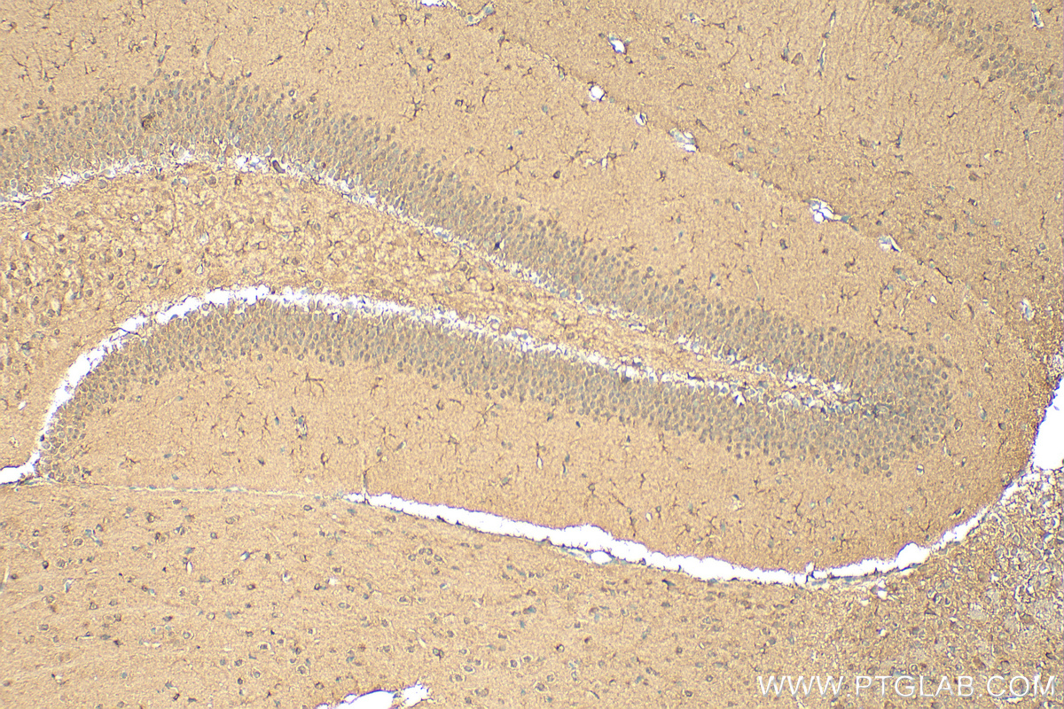 Immunohistochemistry (IHC) staining of mouse brain tissue using CALCOCO1 Polyclonal antibody (19843-1-AP)