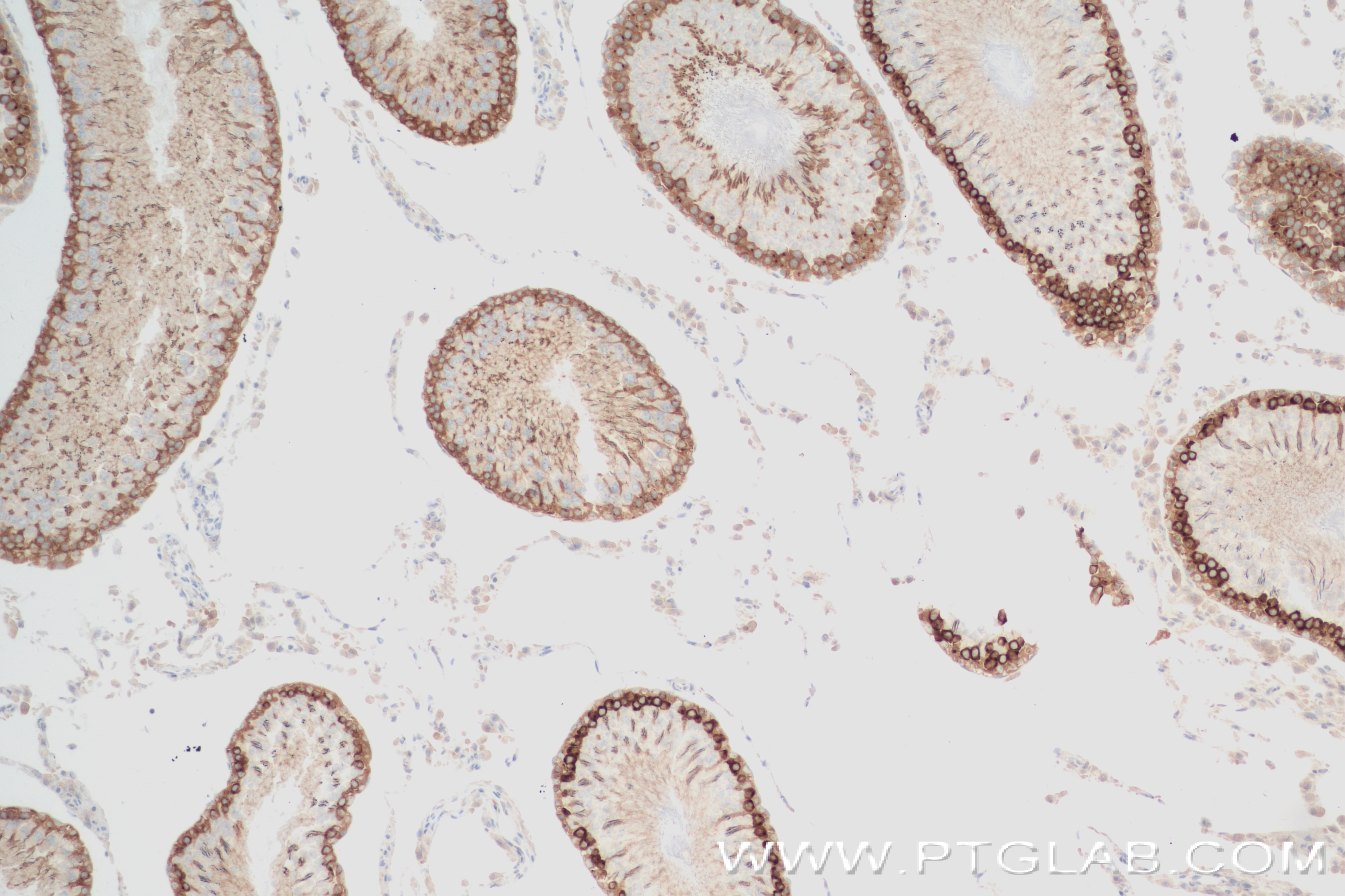 Immunohistochemistry (IHC) staining of rat testis tissue using CALCOCO1 Recombinant antibody (84009-4-RR)