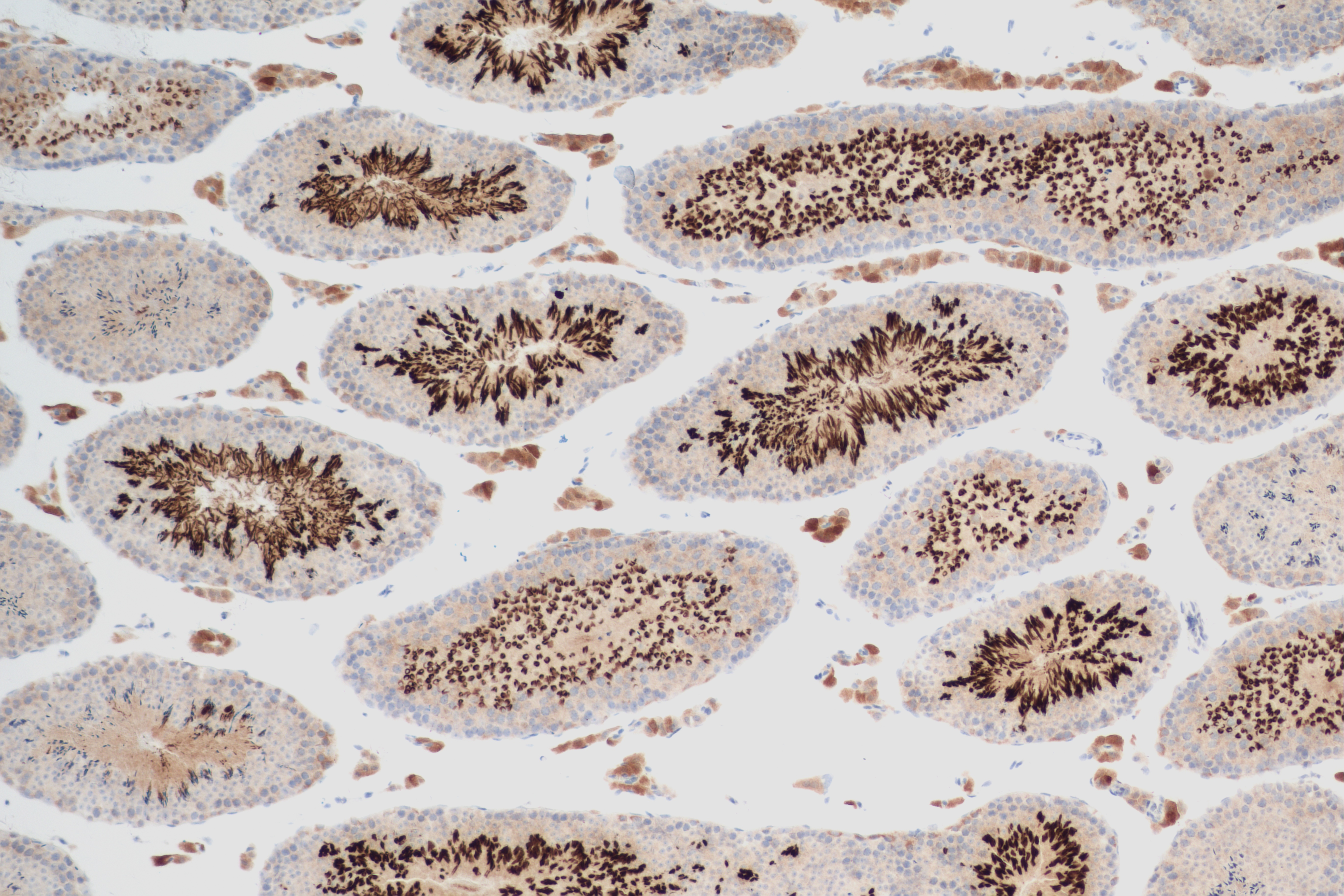 Immunohistochemistry (IHC) staining of mouse testis tissue using CALCOCO1 Recombinant antibody (84009-4-RR)