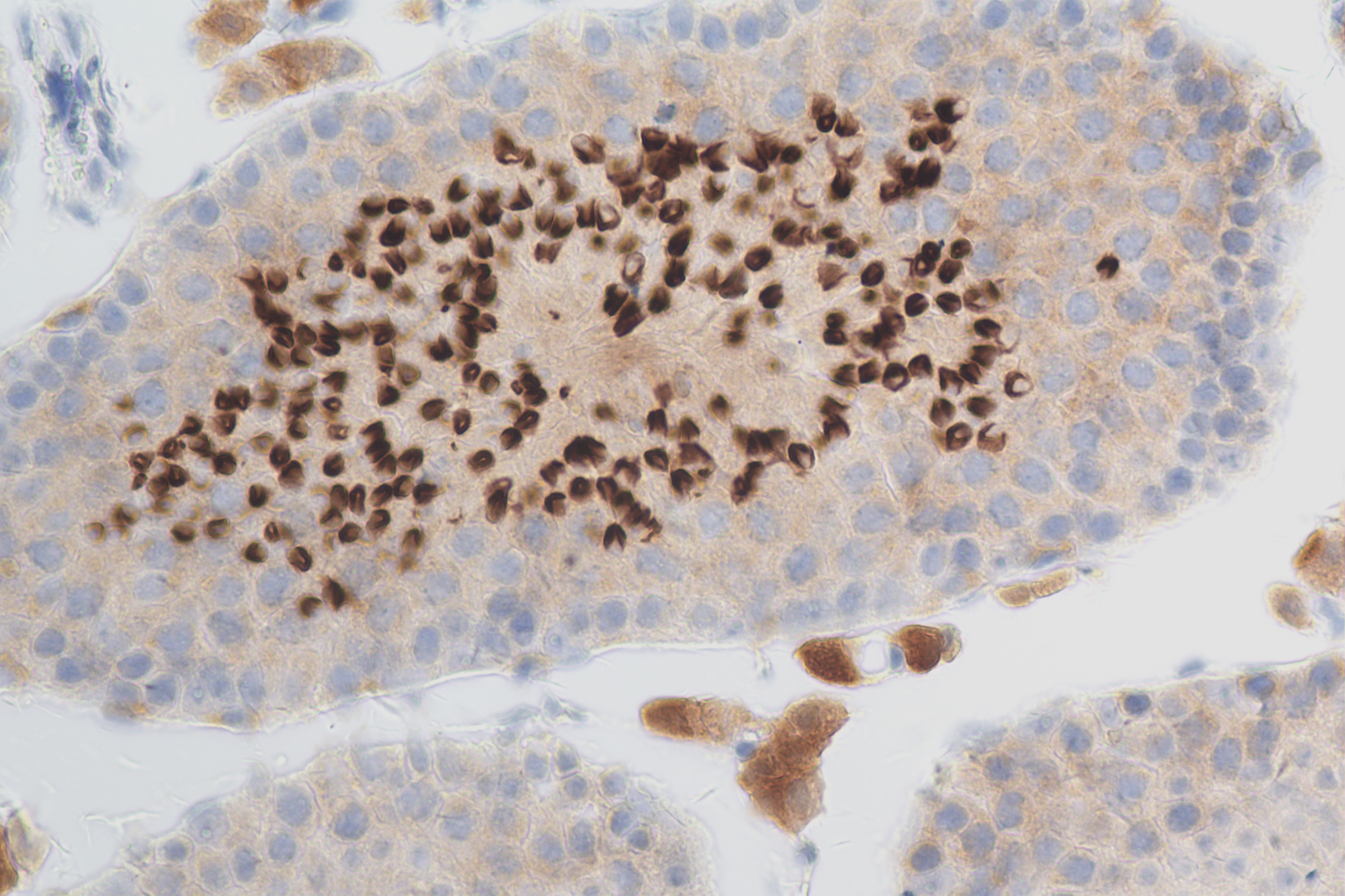 Immunohistochemistry (IHC) staining of mouse testis tissue using CALCOCO1 Recombinant antibody (84009-4-RR)