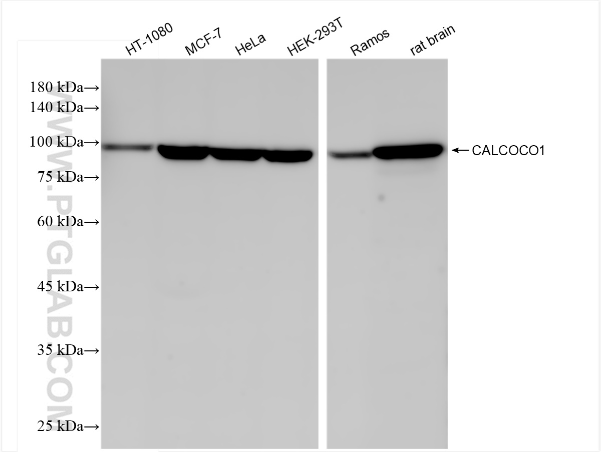 Western Blot (WB) analysis of various lysates using CALCOCO1 Recombinant antibody (84009-4-RR)