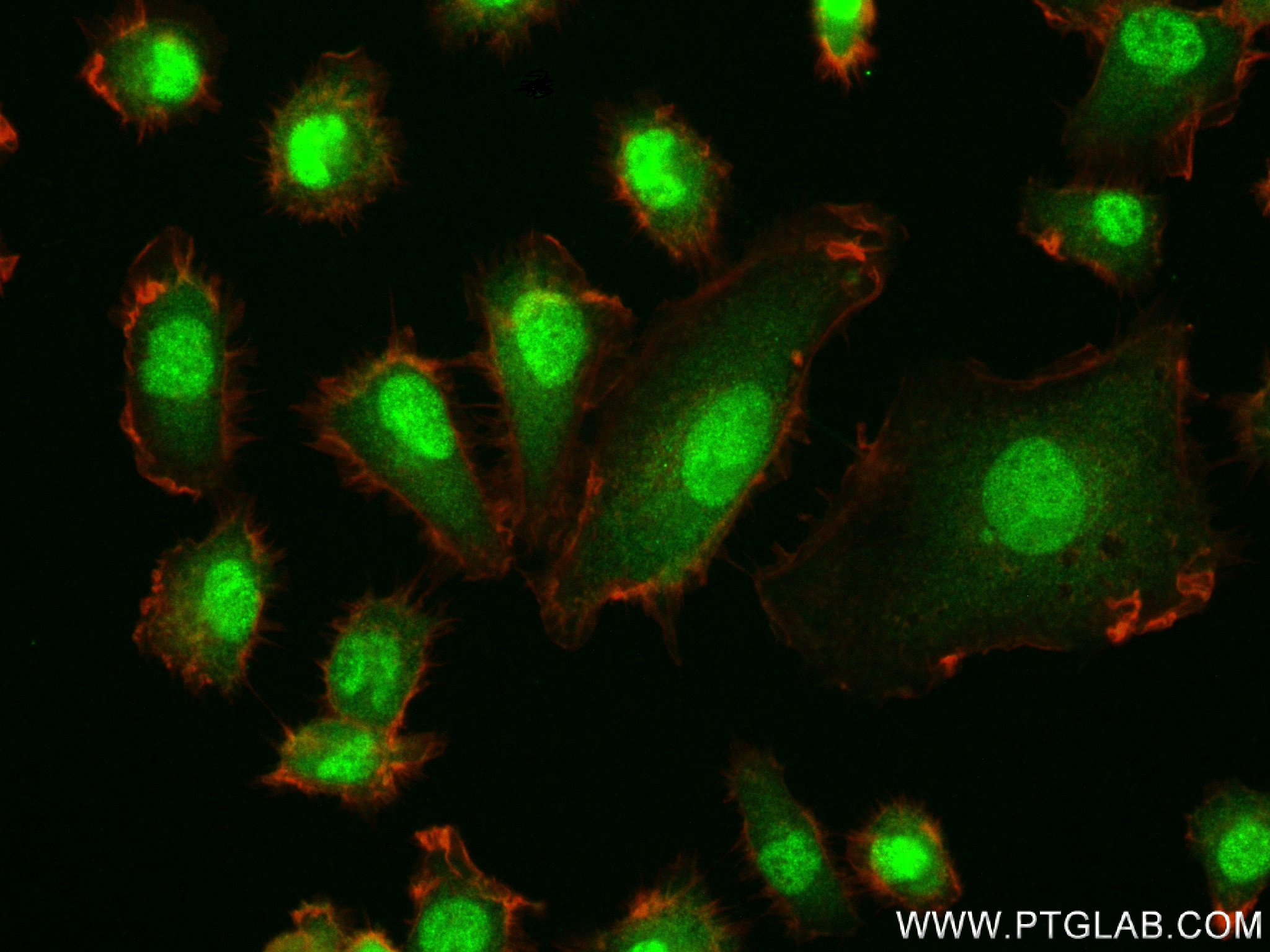 Immunofluorescence (IF) / fluorescent staining of HT-1080 cells using CALCOCO1 Recombinant antibody (84009-5-RR)