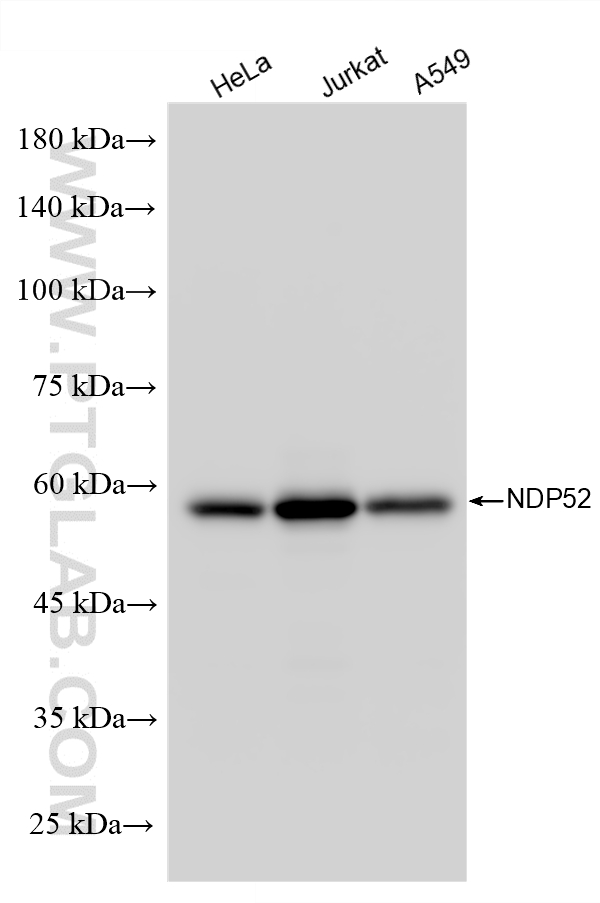 Western Blot (WB) analysis of various lysates using NDP52 Polyclonal antibody (12229-1-AP)
