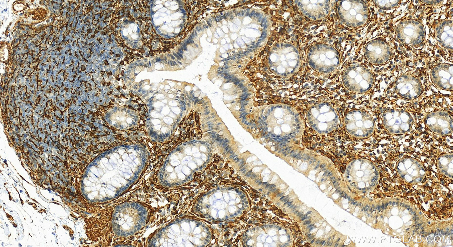 Immunohistochemistry (IHC) staining of human normal colon using Caldesmon Polyclonal antibody (20887-1-AP)