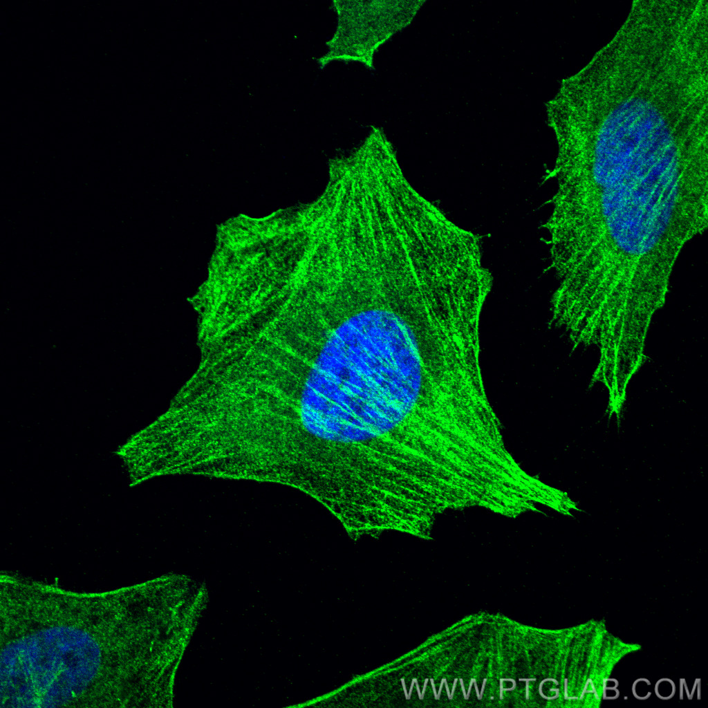 Immunofluorescence (IF) / fluorescent staining of HeLa cells using Caldesmon Polyclonal antibody (20887-1-AP)