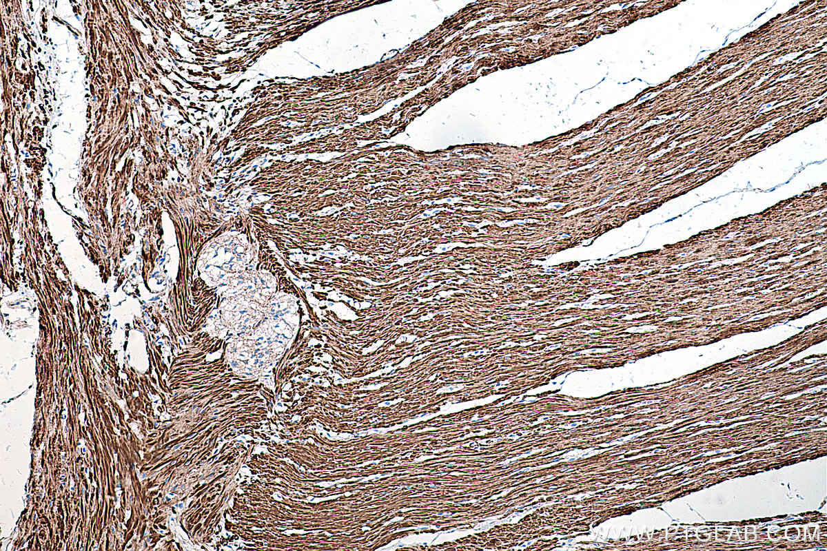 Immunohistochemistry (IHC) staining of human colon tissue using CALD1 Monoclonal antibody (66693-1-Ig)