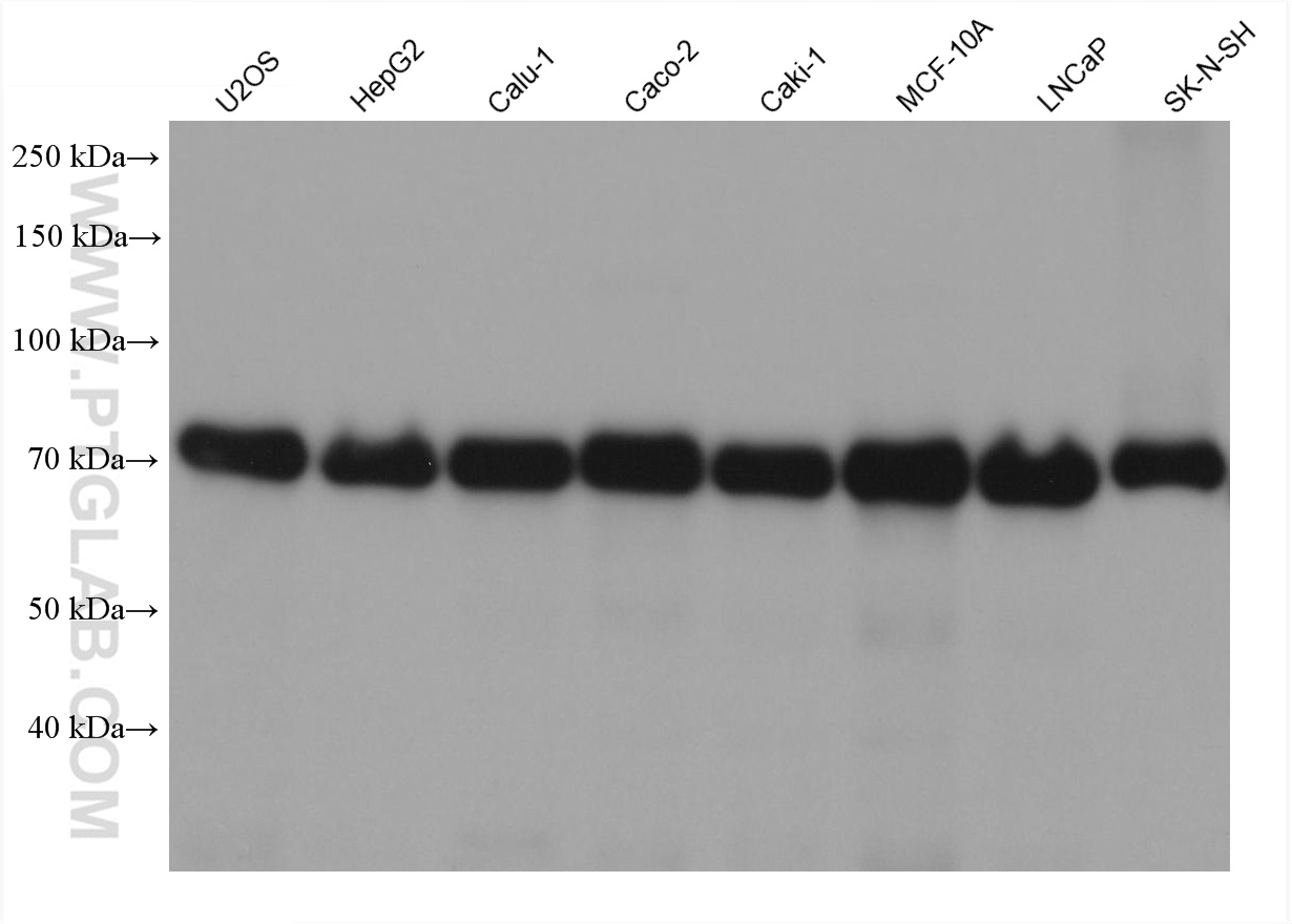 Western Blot (WB) analysis of various lysates using CALD1 Monoclonal antibody (66693-1-Ig)