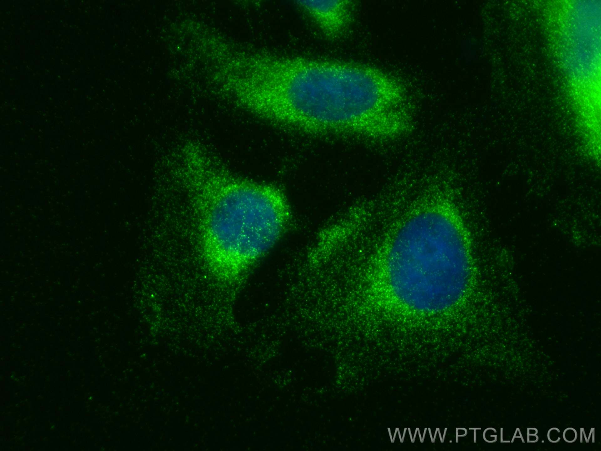 Immunofluorescence (IF) / fluorescent staining of U2OS cells using CALHM2 Polyclonal antibody (19931-1-AP)