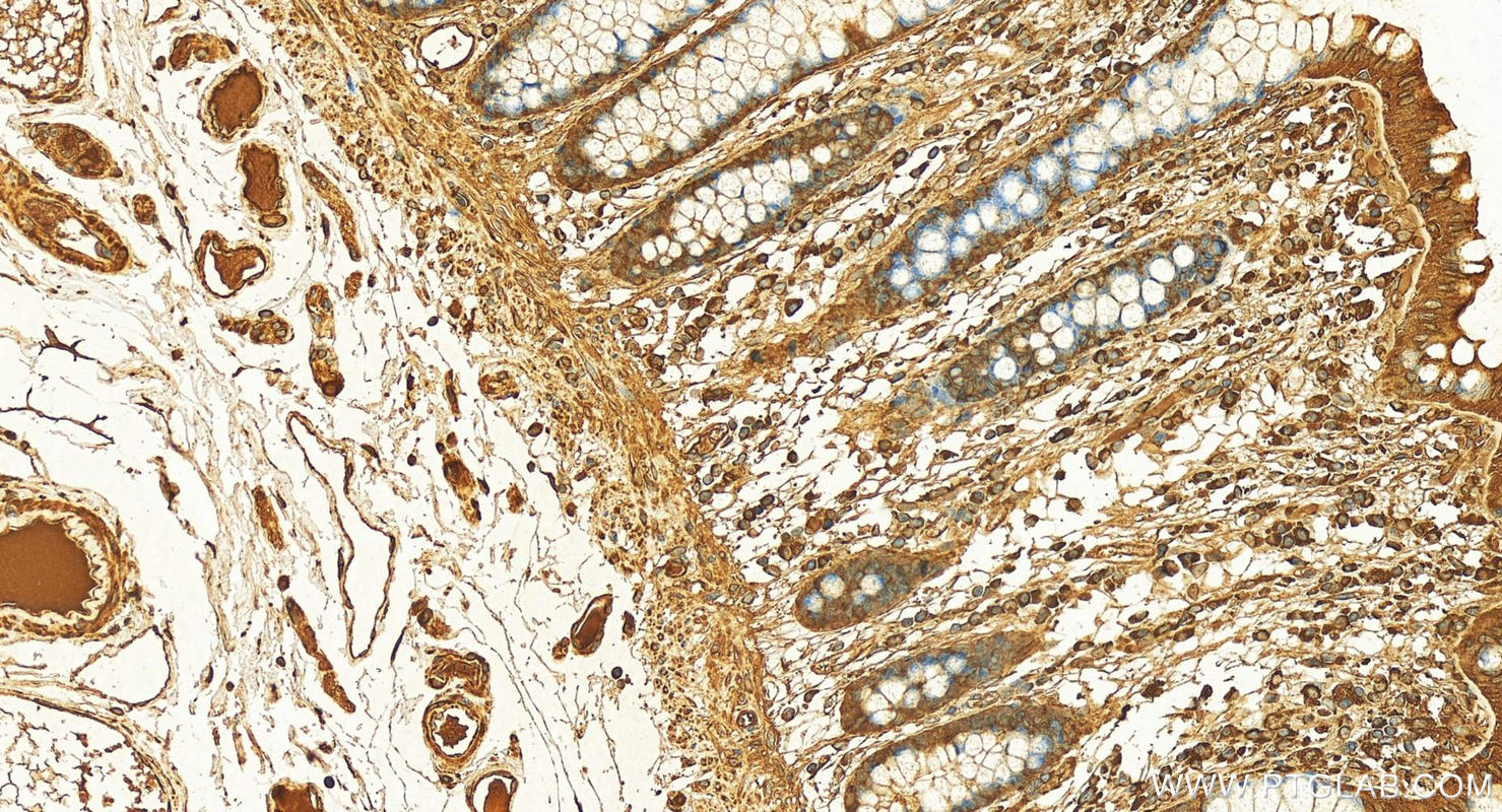 Immunohistochemistry (IHC) staining of human normal colon using calreticulin Polyclonal antibody (10292-1-AP)