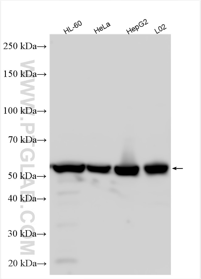 Western Blot (WB) analysis of various lysates using calreticulin Polyclonal antibody (10292-1-AP)
