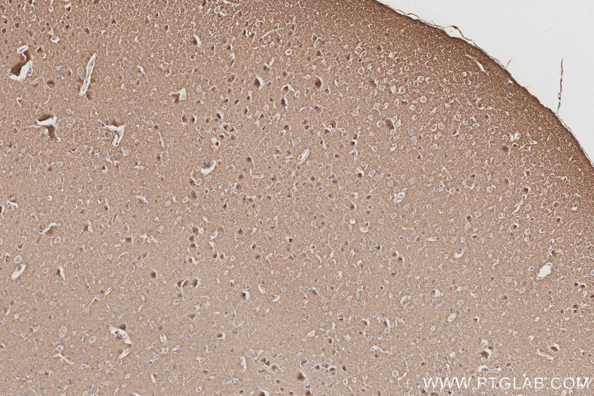 Immunohistochemistry (IHC) staining of mouse brain tissue using CaMK2 alpha Polyclonal antibody (13730-1-AP)