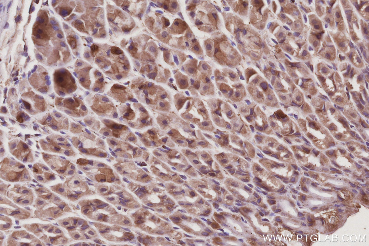 Immunohistochemistry (IHC) staining of mouse stomach tissue using CaMK2 alpha Polyclonal antibody (13730-1-AP)