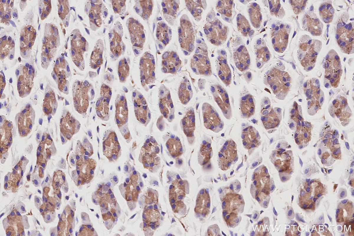 Immunohistochemistry (IHC) staining of rat stomach tissue using CaMK2 alpha Polyclonal antibody (13730-1-AP)