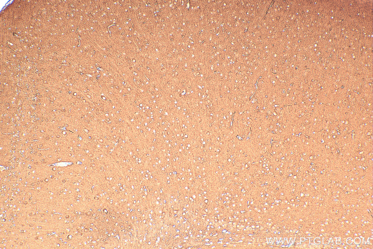 Immunohistochemistry (IHC) staining of mouse brain tissue using CAMK2B Polyclonal antibody (11533-1-AP)