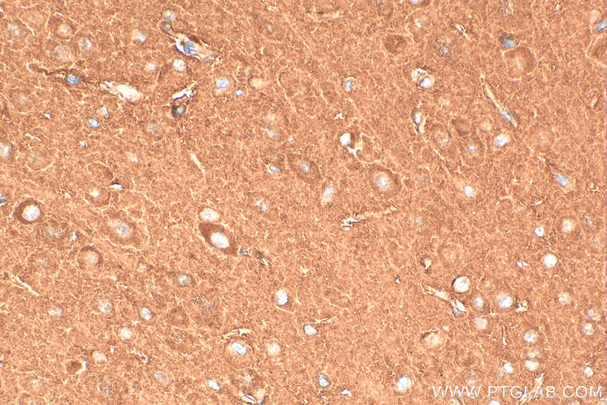 Immunohistochemistry (IHC) staining of mouse brain tissue using CAMK2B Polyclonal antibody (11533-1-AP)