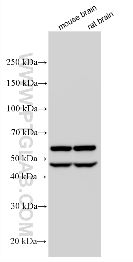 Western Blot (WB) analysis of various lysates using CAMK2B Polyclonal antibody (11533-1-AP)