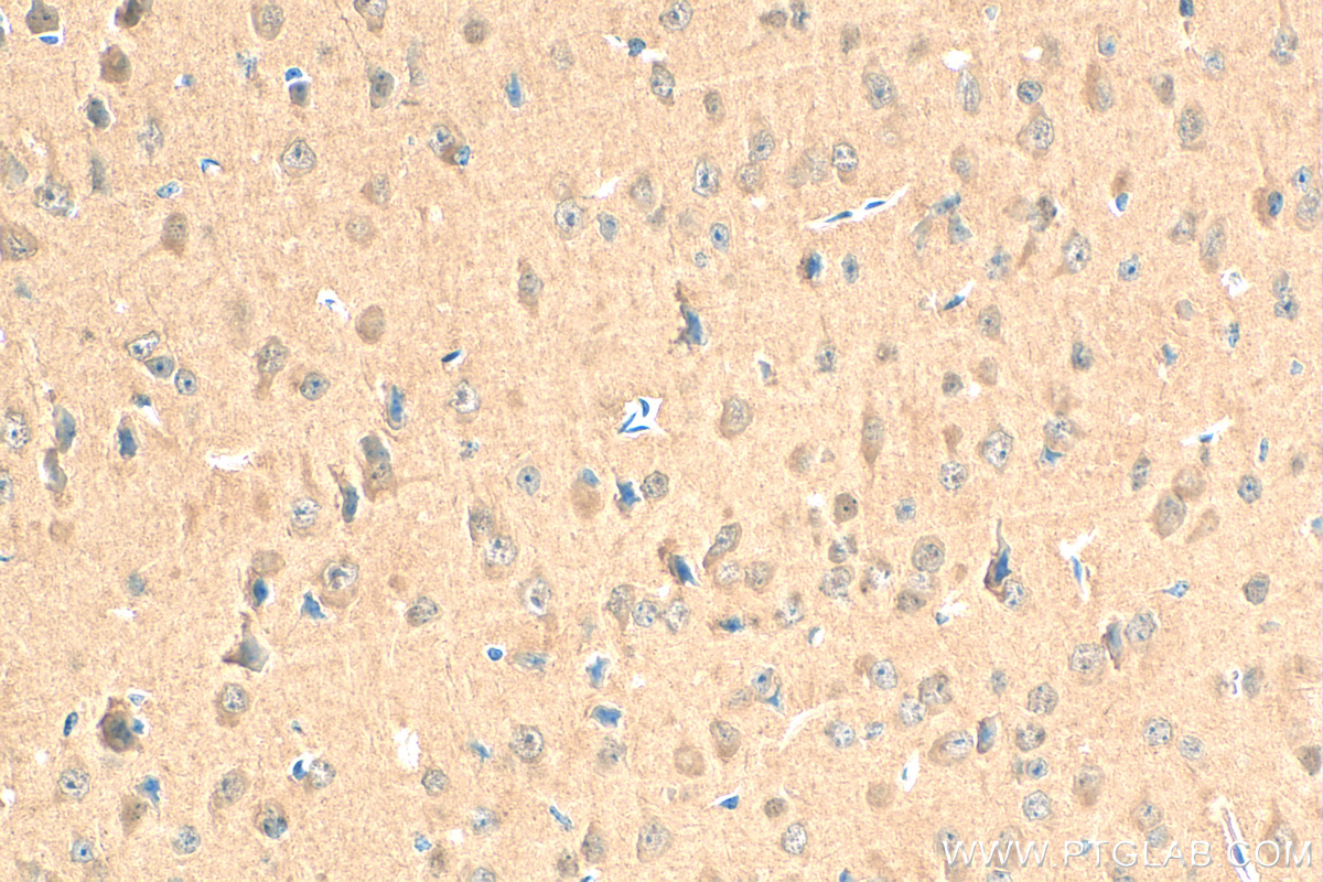 Immunohistochemistry (IHC) staining of mouse brain tissue using CAMK2D Recombinant antibody (81014-1-RR)