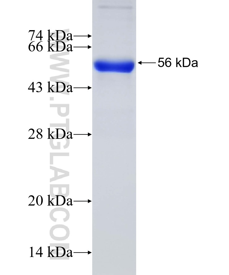 CAMK2D fusion protein Ag30507 SDS-PAGE