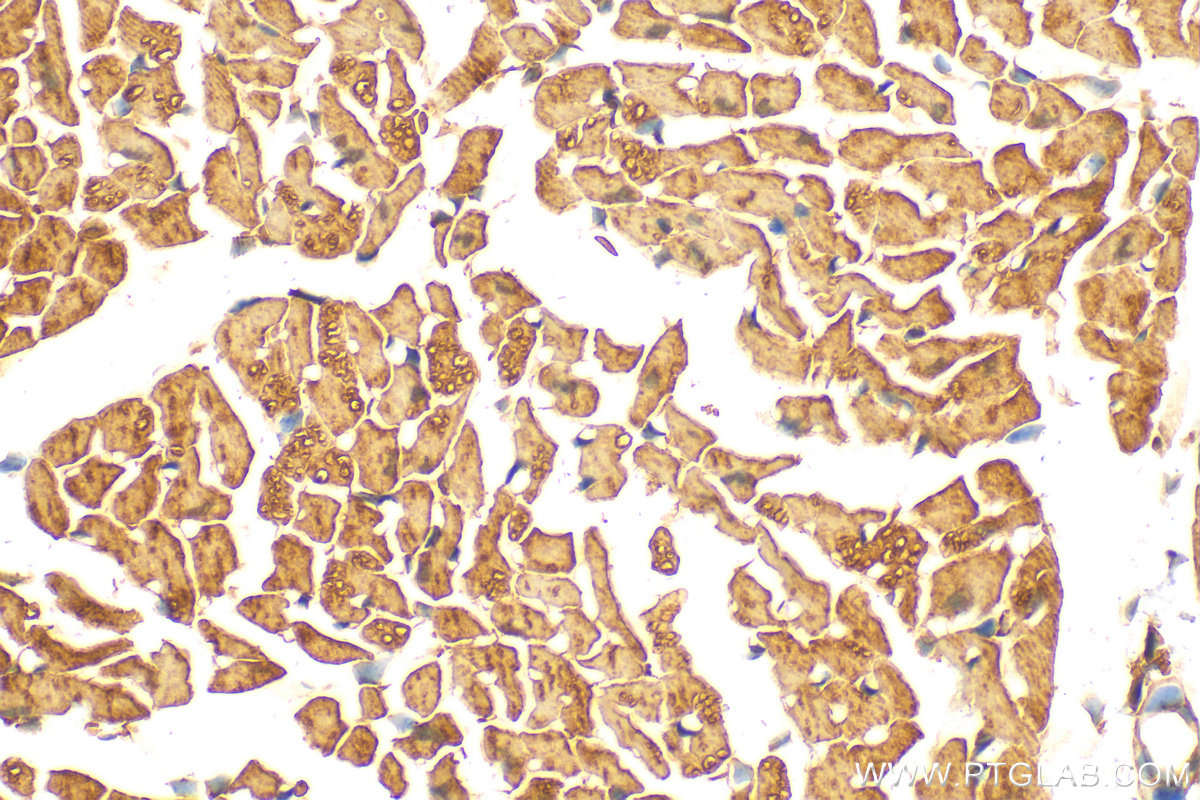 Immunohistochemistry (IHC) staining of mouse heart tissue using CaMKII Gamma Polyclonal antibody (12666-2-AP)