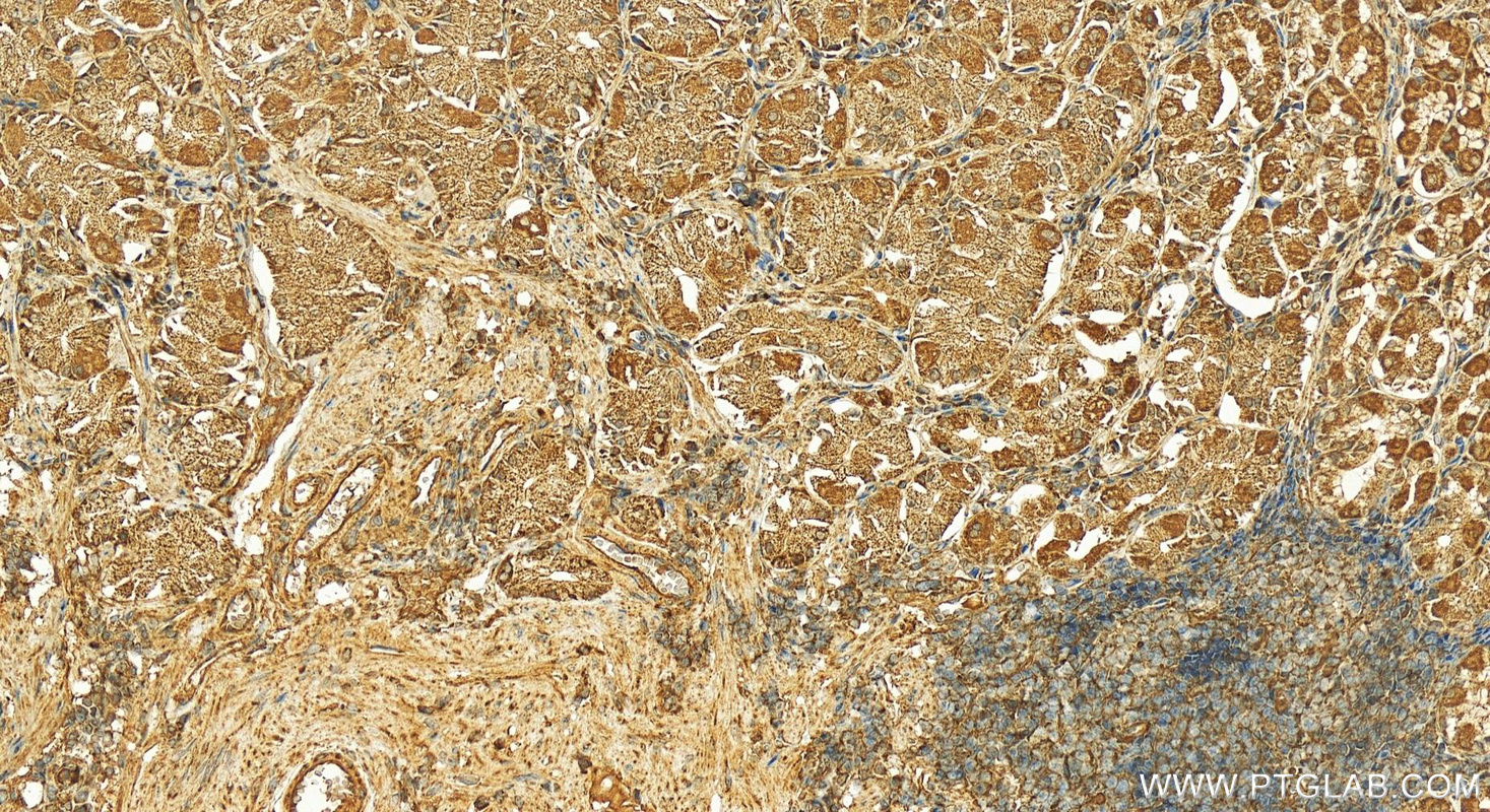 Immunohistochemistry (IHC) staining of human stomach tissue using CAMKK1 Polyclonal antibody (13624-1-AP)