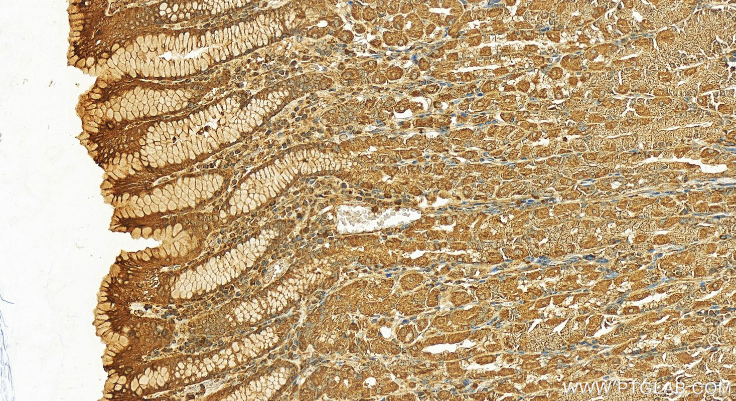 Immunohistochemistry (IHC) staining of human stomach tissue using CAMKK1 Polyclonal antibody (13624-1-AP)