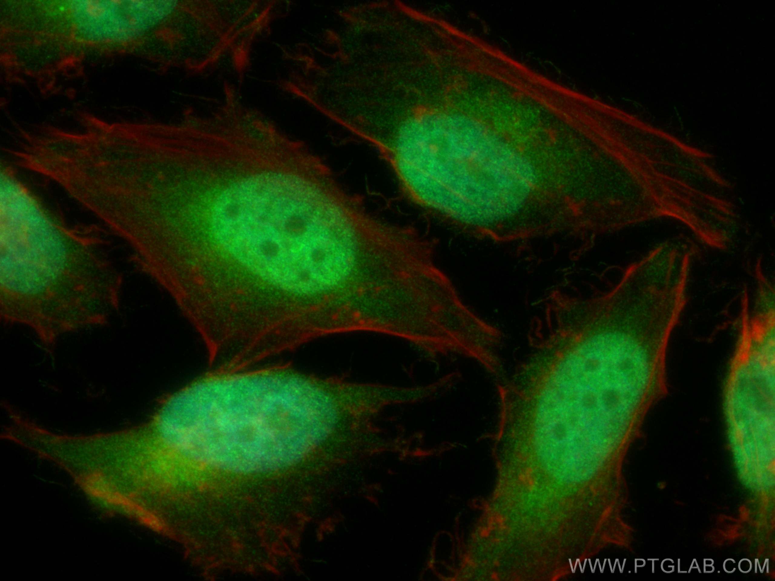 Immunofluorescence (IF) / fluorescent staining of HeLa cells using CAMKMT Polyclonal antibody (27970-1-AP)