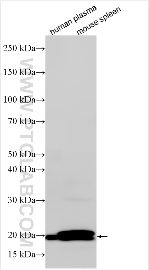 Western Blot (WB) analysis of various lysates using CAMP Polyclonal antibody (12009-1-AP)