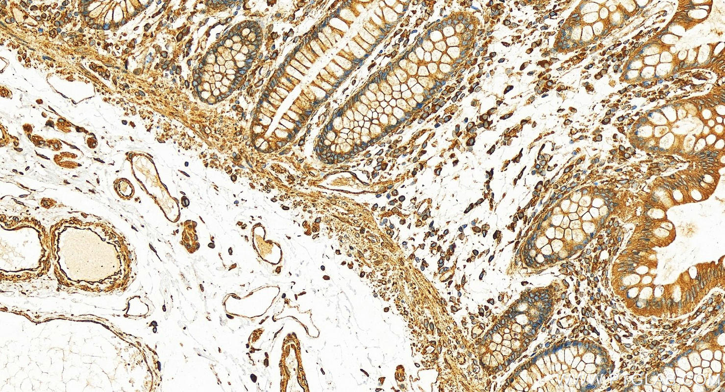 Immunohistochemistry (IHC) staining of human colon tissue using Calnexin Polyclonal antibody (10427-2-AP)