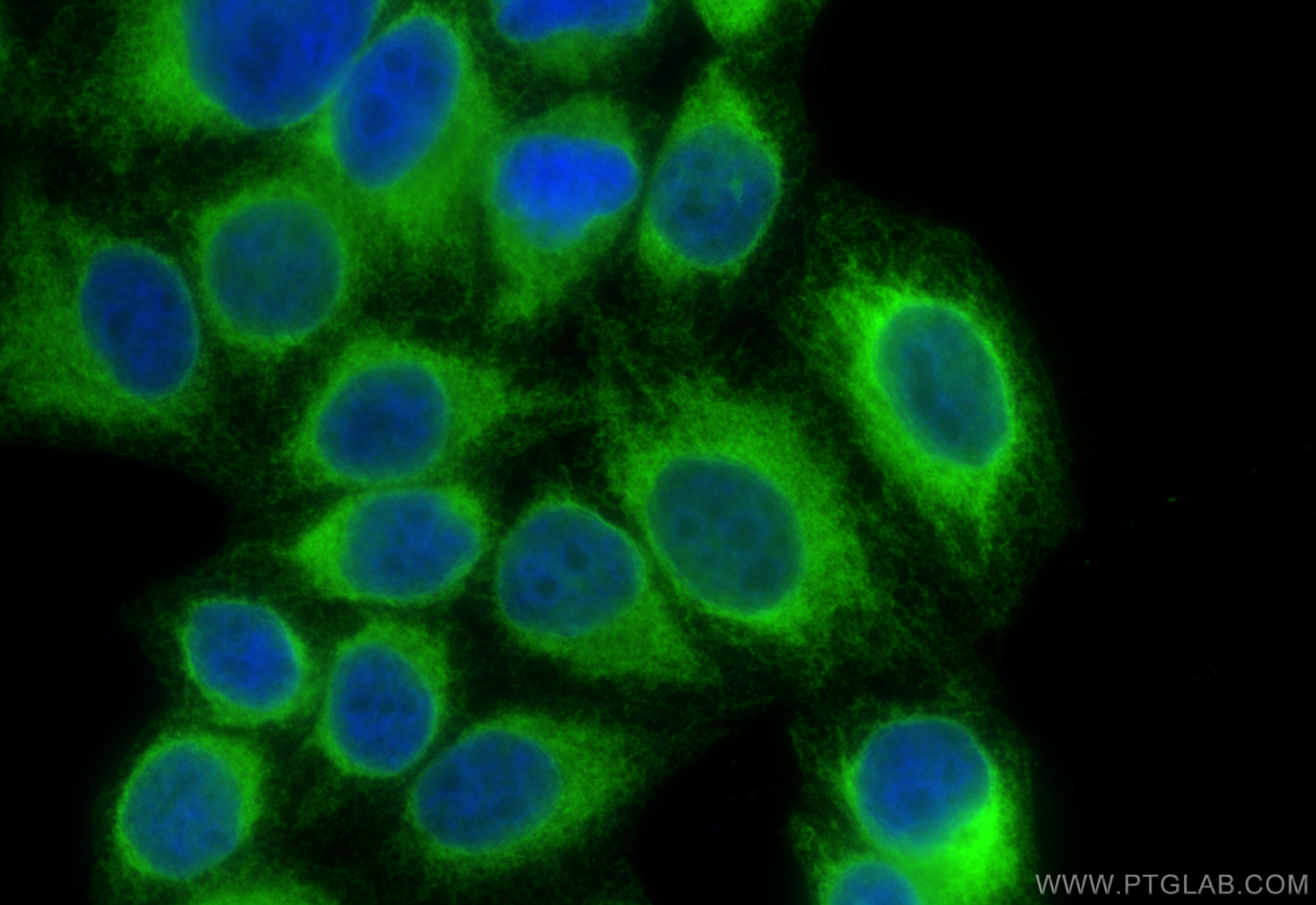 Immunofluorescence (IF) / fluorescent staining of HepG2 cells using Calnexin Polyclonal antibody (10427-2-AP)