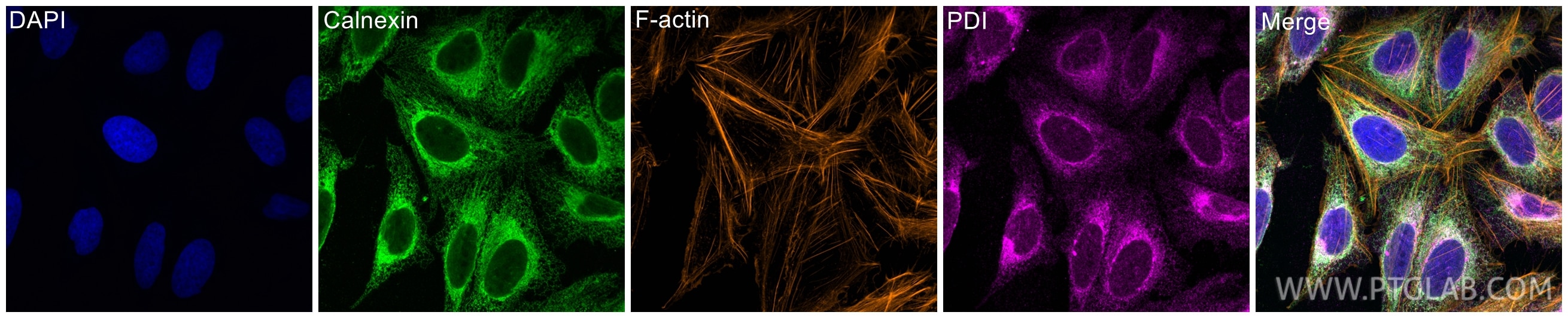 Immunofluorescence (IF) / fluorescent staining of U2OS cells using Calnexin Polyclonal antibody (10427-2-AP)