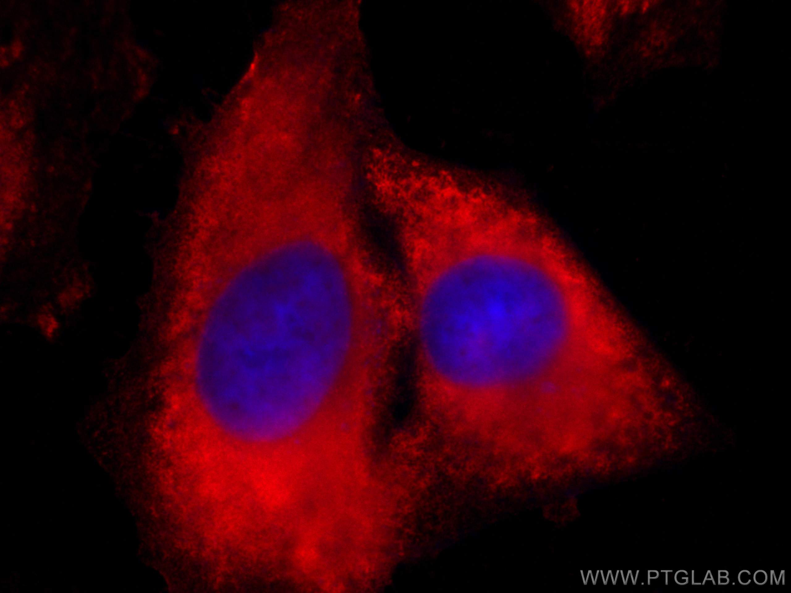 Immunofluorescence (IF) / fluorescent staining of HeLa cells using CoraLite®594-conjugated CAPG Monoclonal antibody (CL594-66277)