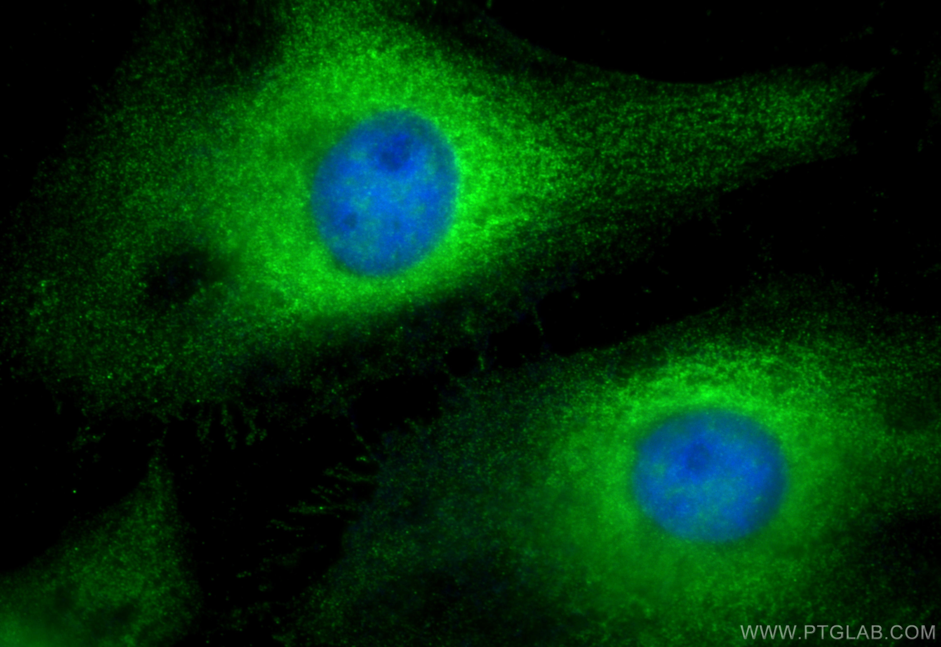 Immunofluorescence (IF) / fluorescent staining of HeLa cells using Calpain 11 Polyclonal antibody (13675-1-AP)