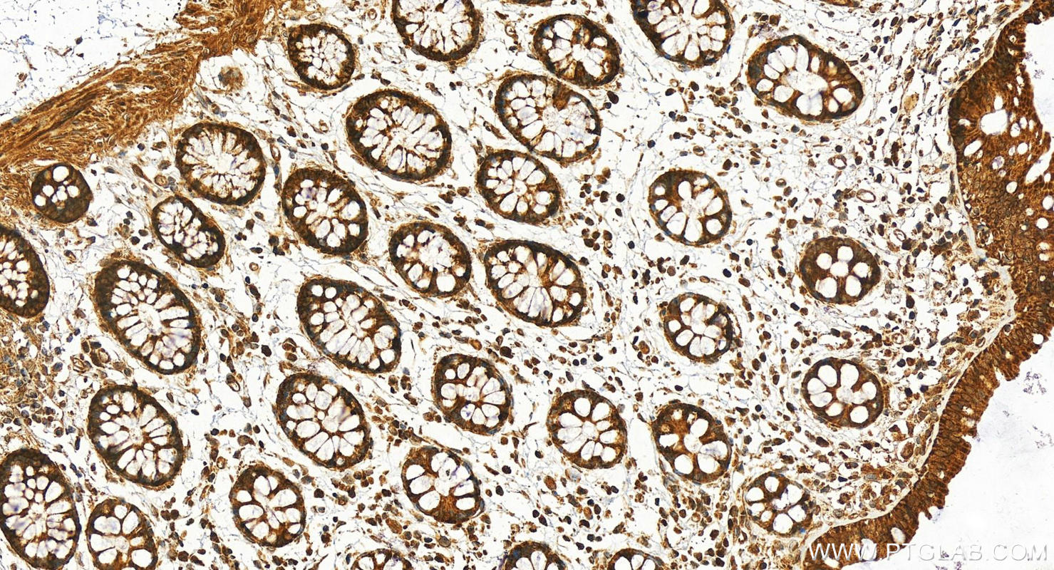 Immunohistochemistry (IHC) staining of human colon tissue using CAPN13 Polyclonal antibody (55371-1-AP)