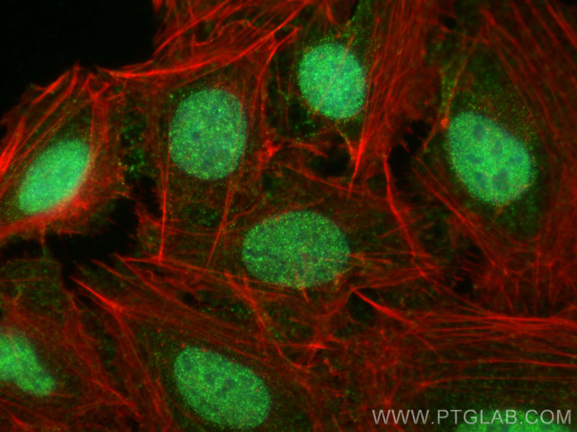 Immunofluorescence (IF) / fluorescent staining of U2OS cells using CAPN3 Monoclonal antibody (67366-1-Ig)