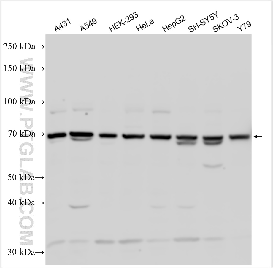 Western Blot (WB) analysis of various lysates using CAPN5 Polyclonal antibody (29809-1-AP)