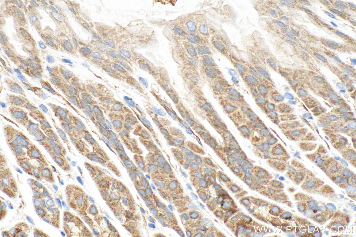 Immunohistochemistry (IHC) staining of mouse stomach tissue using CAPN8 Polyclonal antibody (20971-1-AP)