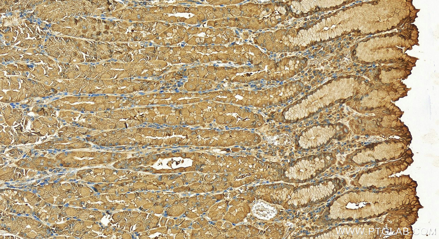 Immunohistochemistry (IHC) staining of human stomach tissue using CAPNS1 Polyclonal antibody (25057-1-AP)