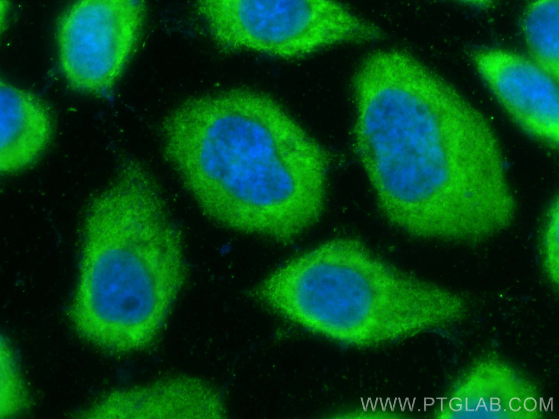 Immunofluorescence (IF) / fluorescent staining of A431 cells using CoraLite® Plus 488-conjugated CAPNS1 Monoclonal an (CL488-67838)