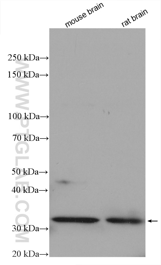 Western Blot (WB) analysis of various lysates using CAPZA1 Polyclonal antibody (11806-1-AP)
