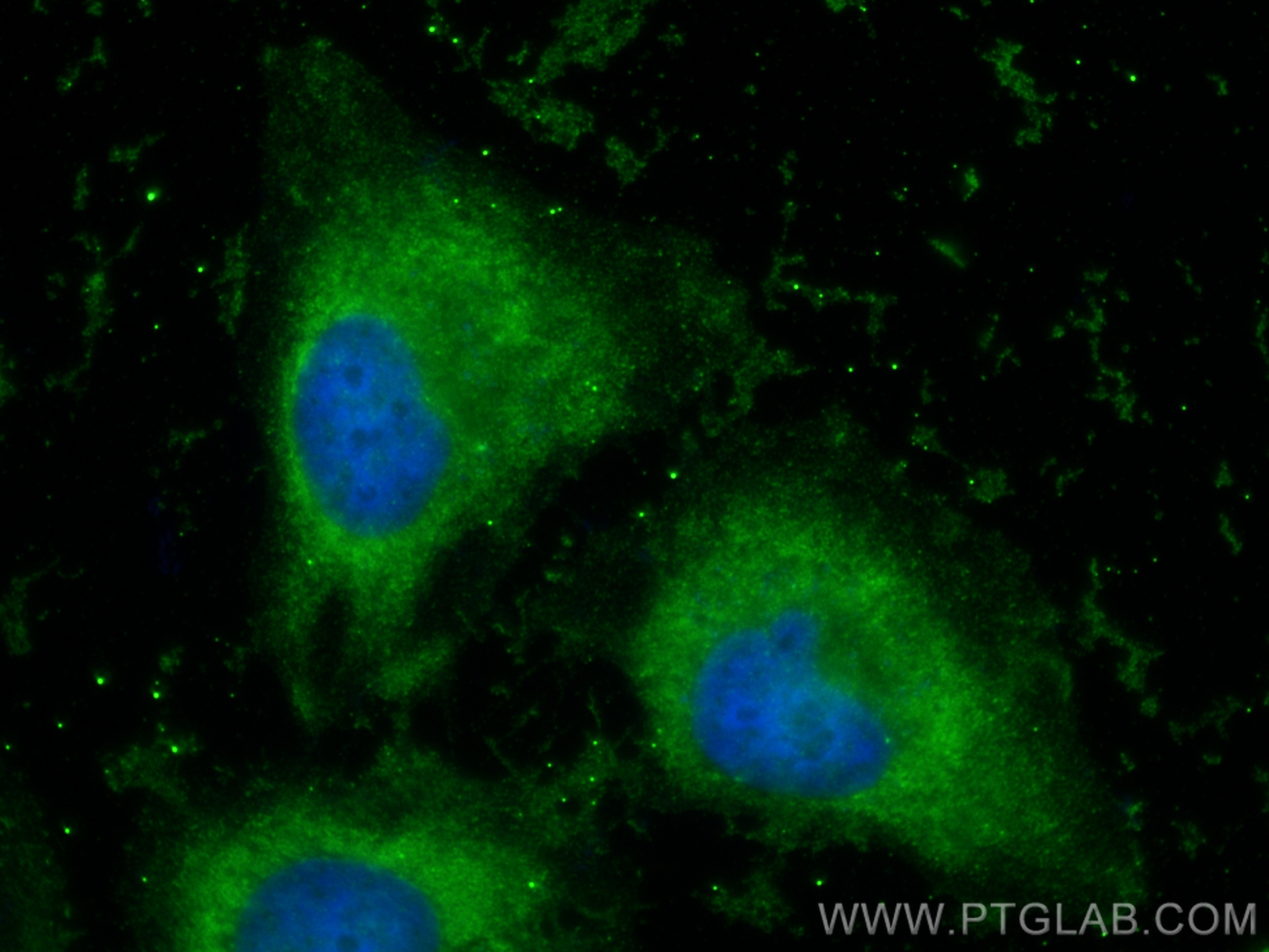 Immunofluorescence (IF) / fluorescent staining of HeLa cells using CAPZA1 Monoclonal antibody (66066-1-Ig)