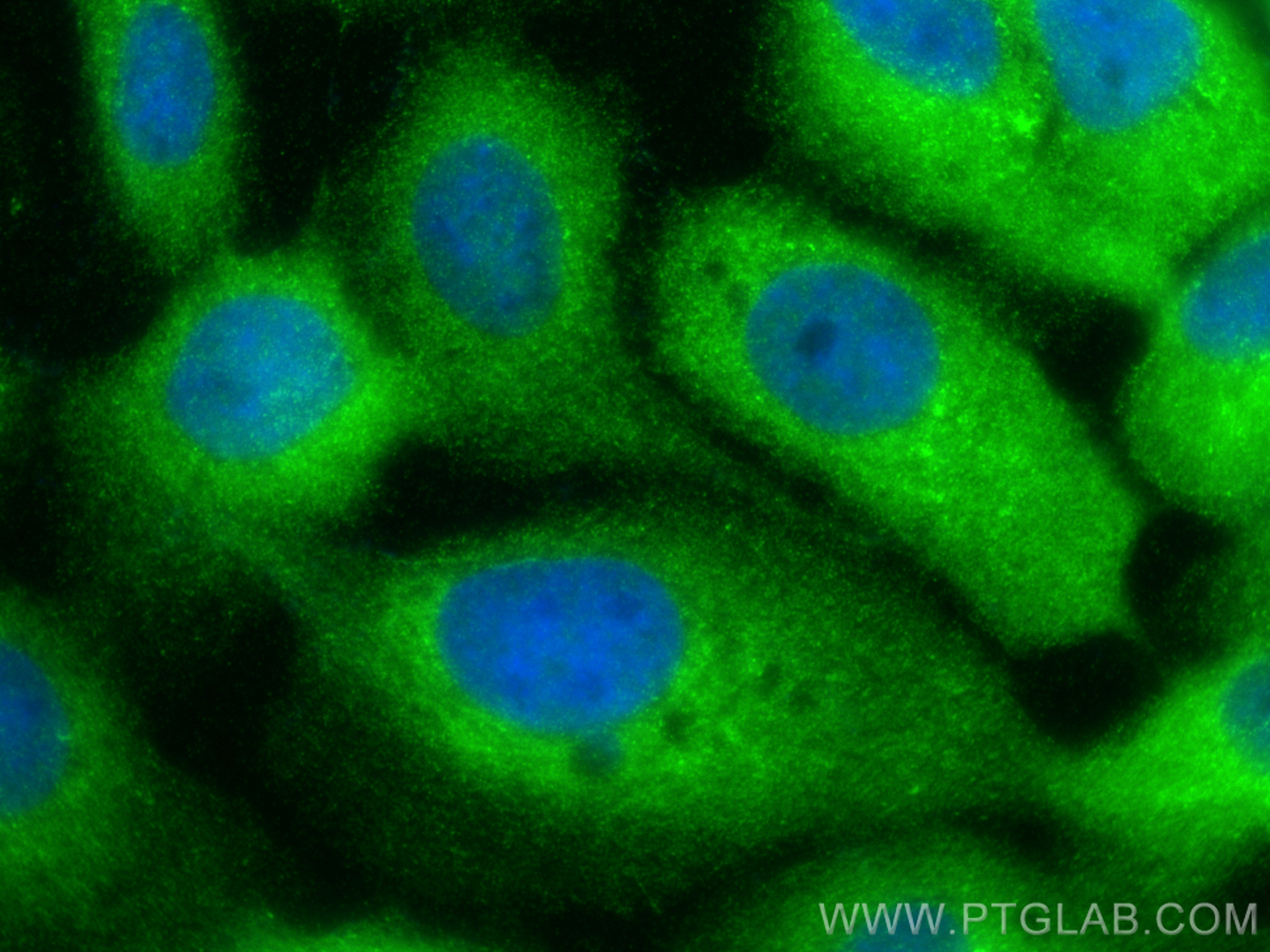 Immunofluorescence (IF) / fluorescent staining of A431 cells using CAPZB Polyclonal antibody (25043-1-AP)