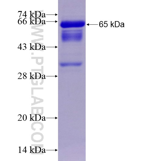 CARD14 fusion protein Ag28969 SDS-PAGE