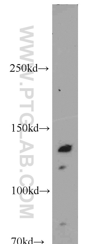 Western Blot (WB) analysis of HepG2 cells using CARD6 Polyclonal antibody (18029-1-AP)