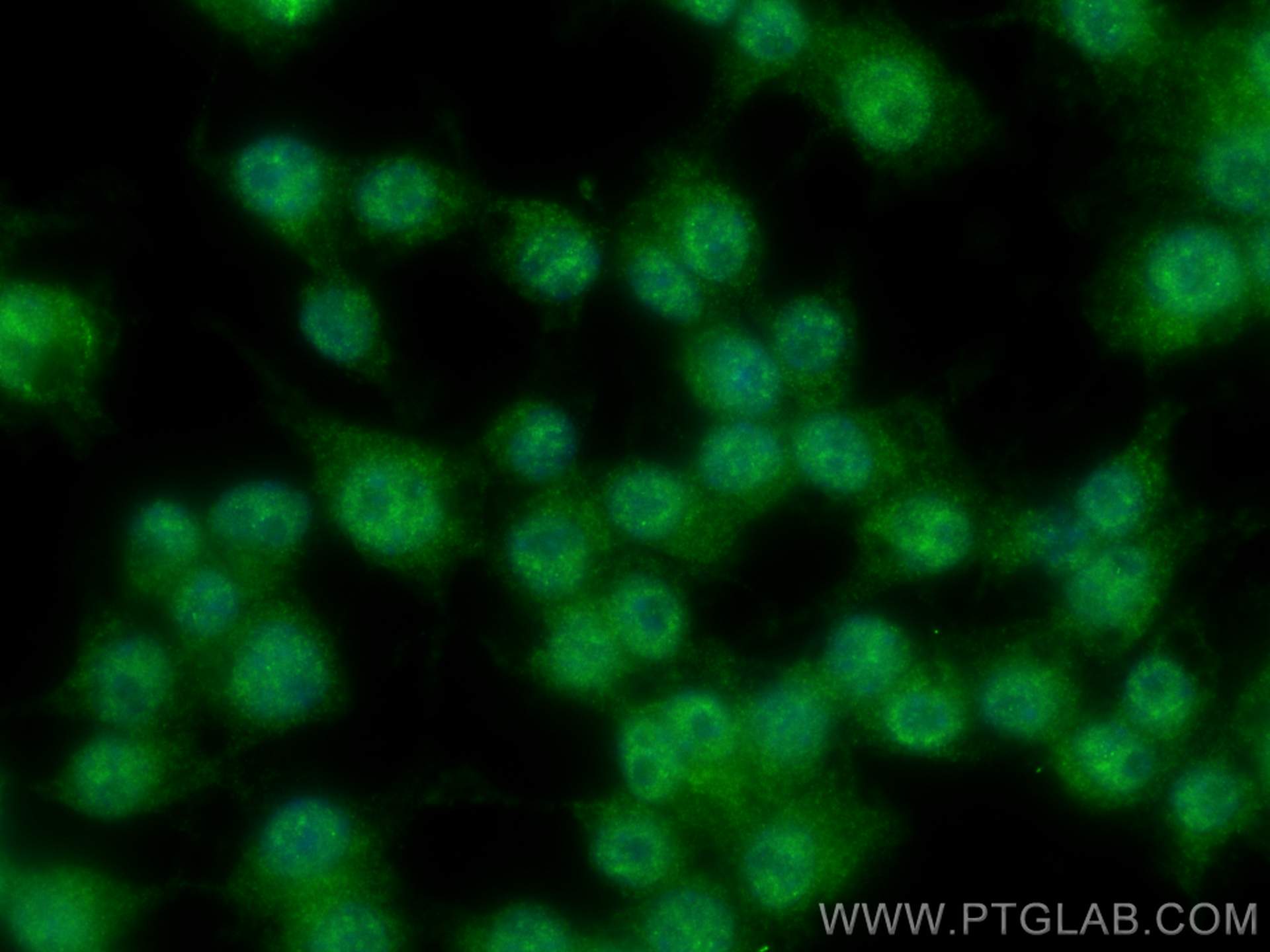 Immunofluorescence (IF) / fluorescent staining of RAW 264.7 cells using CARD8 Polyclonal antibody (14516-1-AP)