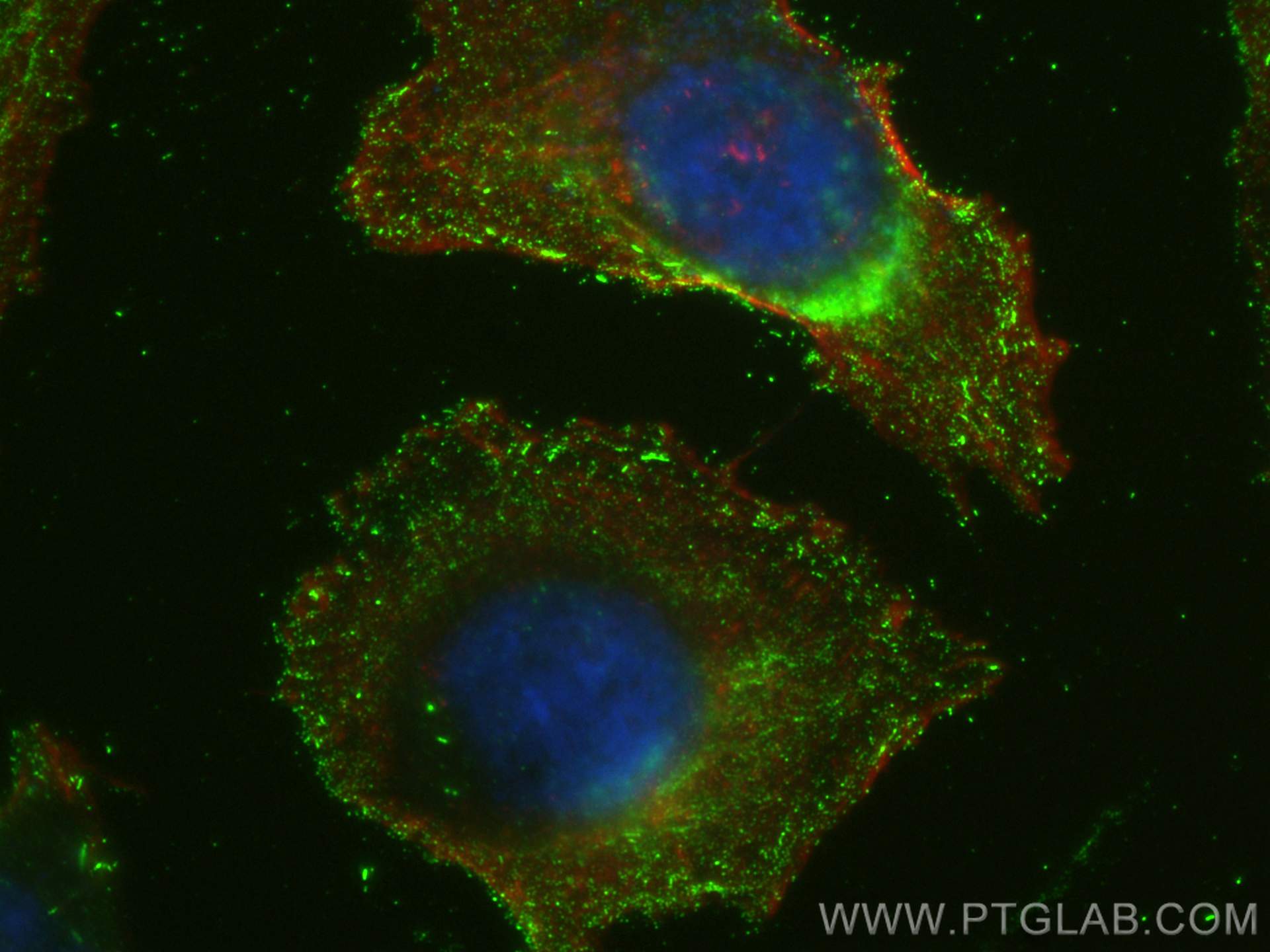 Immunofluorescence (IF) / fluorescent staining of HeLa cells using CARD9 Monoclonal antibody (68657-1-Ig)