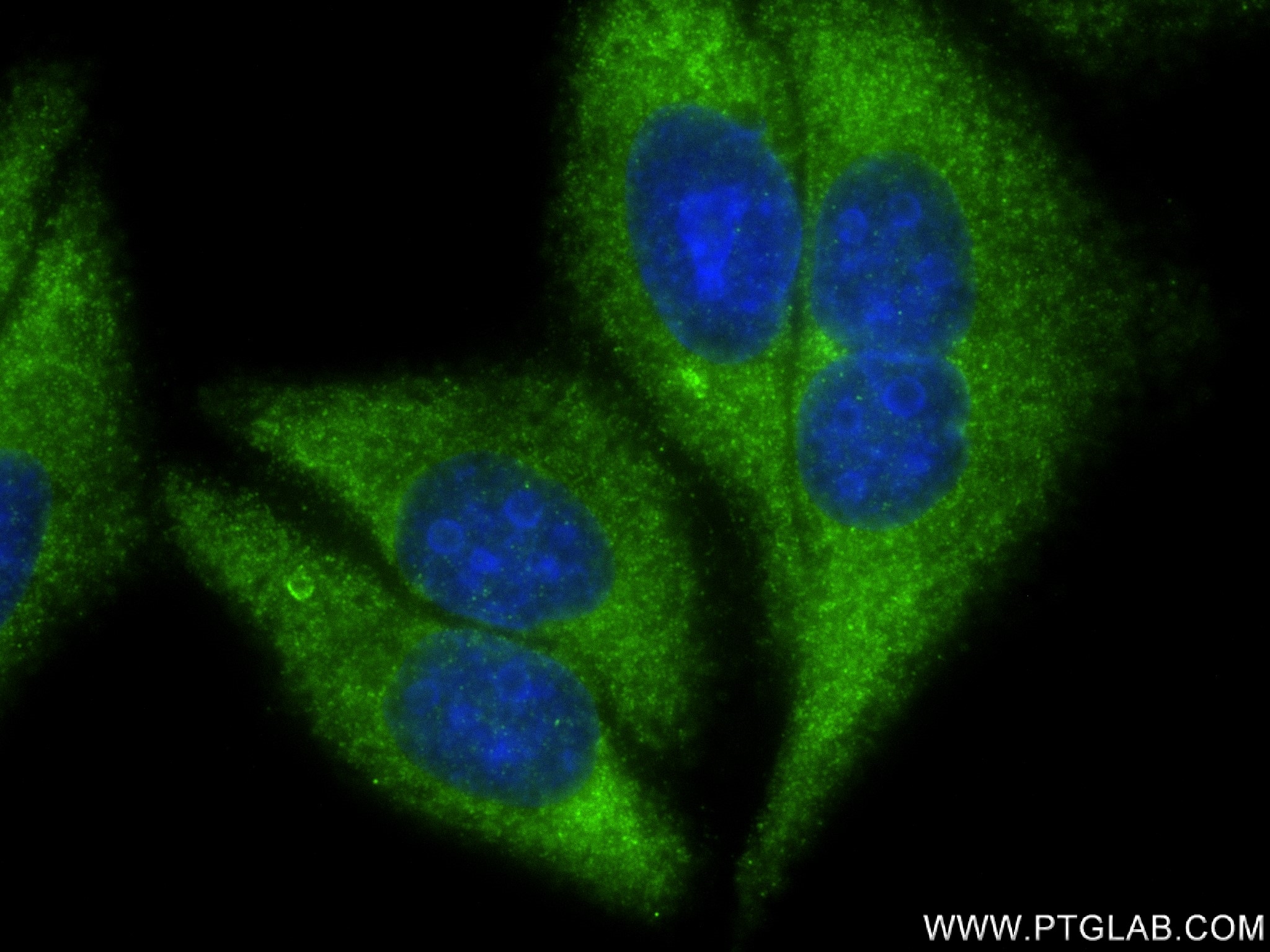 Immunofluorescence (IF) / fluorescent staining of HepG2 cells using CARHSP1 Recombinant antibody (83300-2-RR)