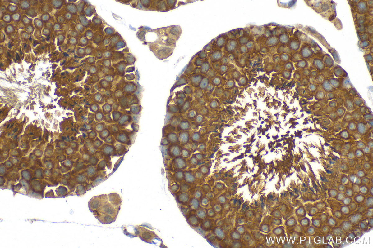 Immunohistochemistry (IHC) staining of mouse testis tissue using CARHSP1 Recombinant antibody (83300-2-RR)